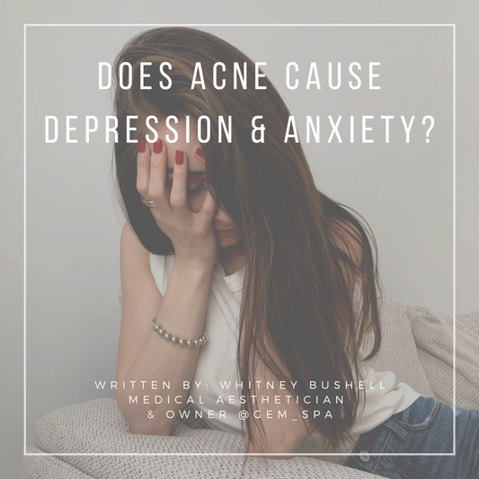 DOES ACNE CAUSE DEPRESSION & ANXIETY?