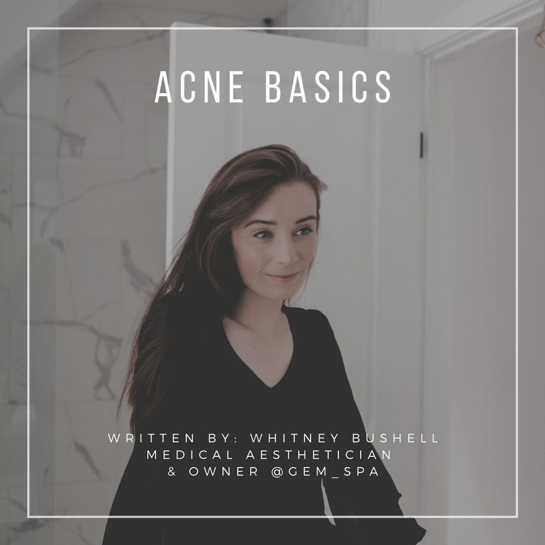 Acne Basics